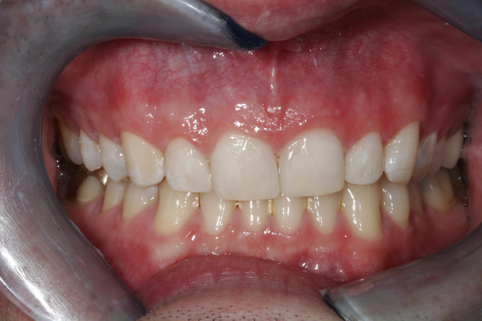 Smile Gallery Dentist in Milwaukie, OR