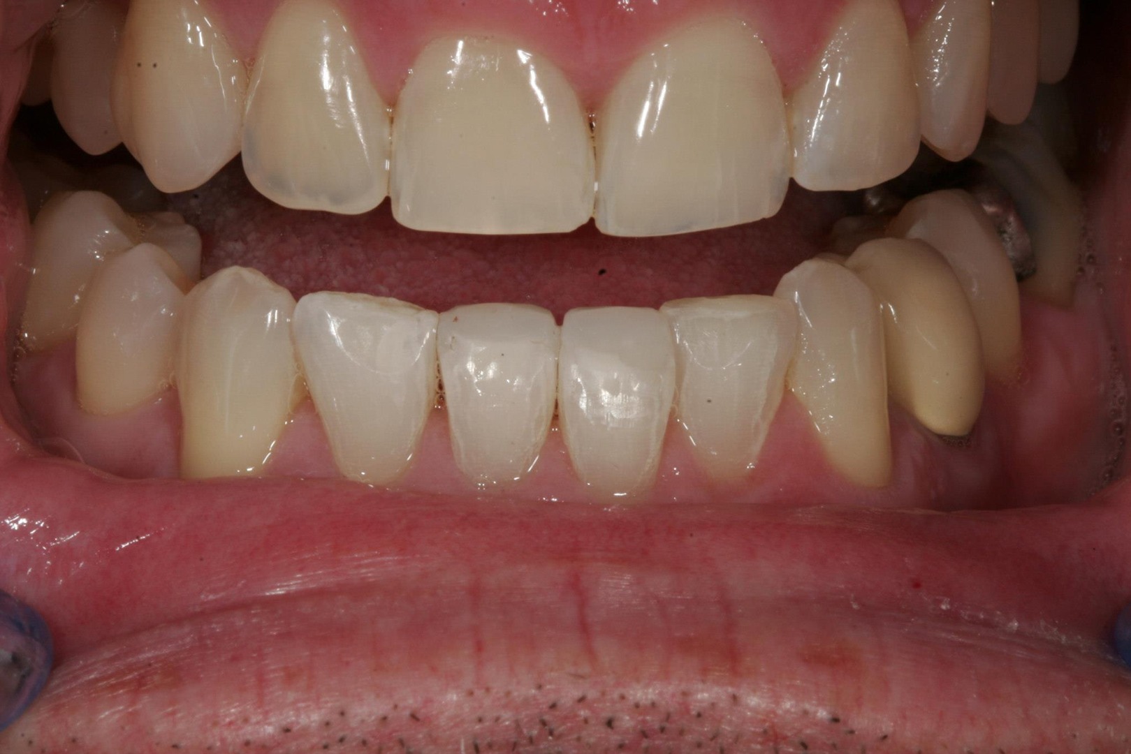 Smile Gallery Dentist in Milwaukie, OR