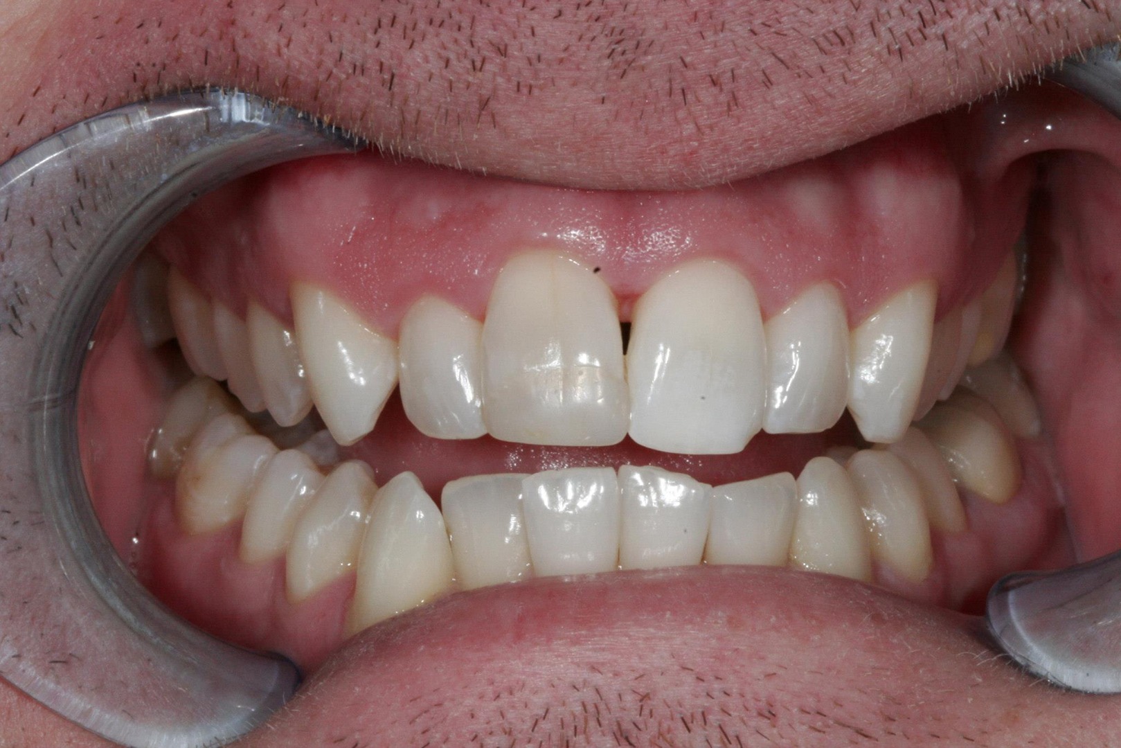 Smile Gallery Dentist in Milwaukie, OR